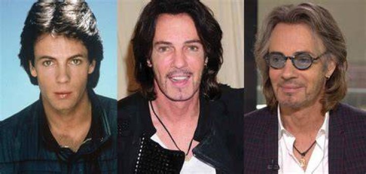 
Has Rick Springfield had Plastic Surgery? 